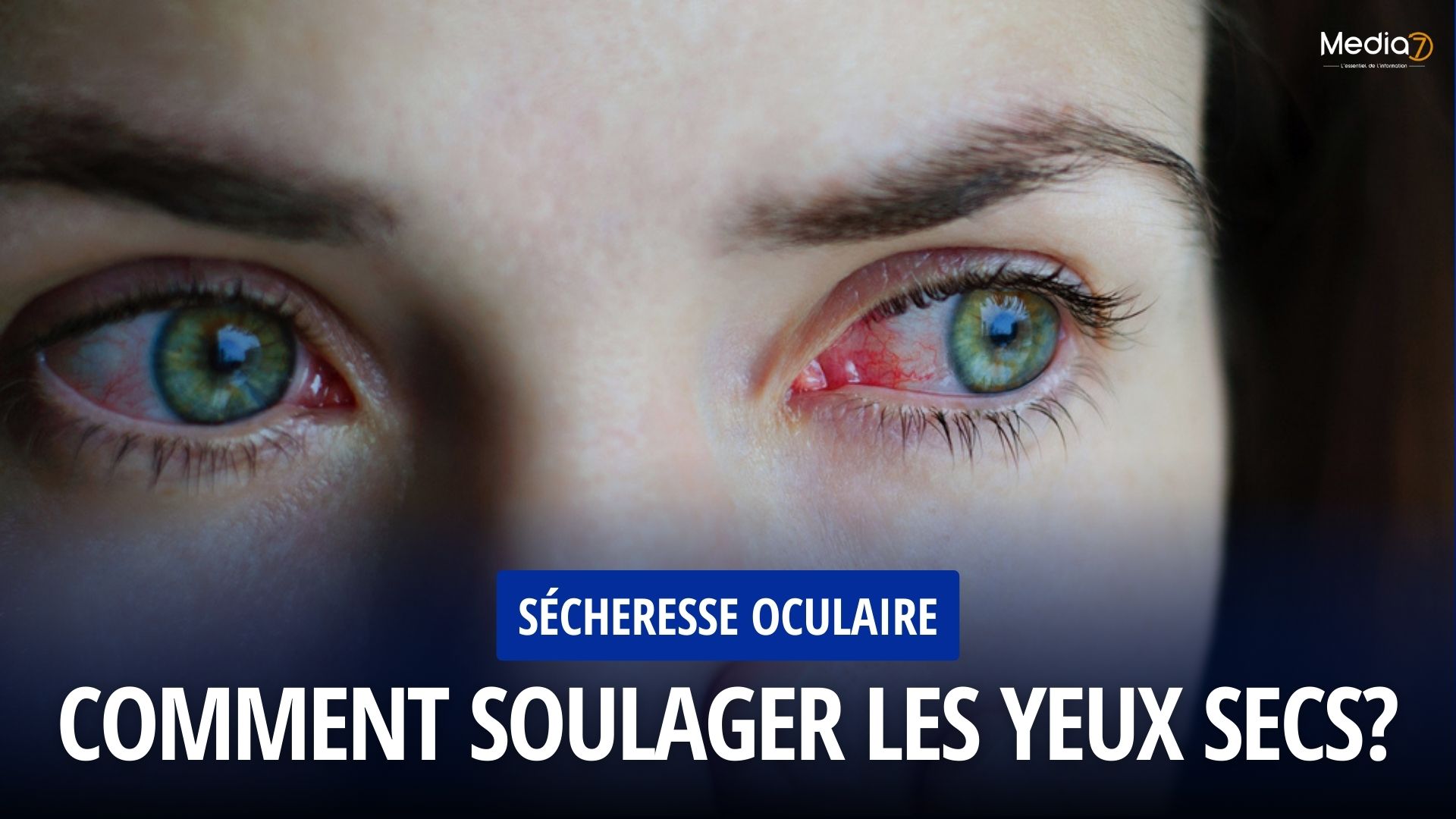 Sécheresse Oculaire