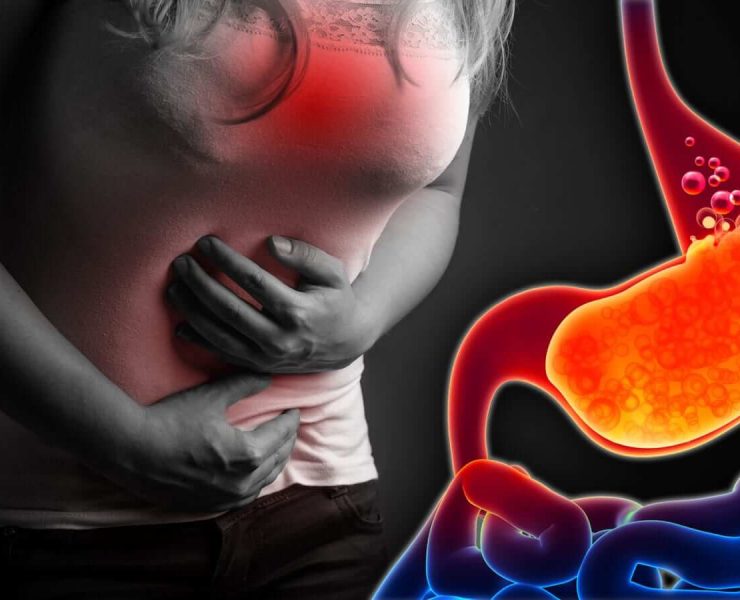 ulcères gastriques