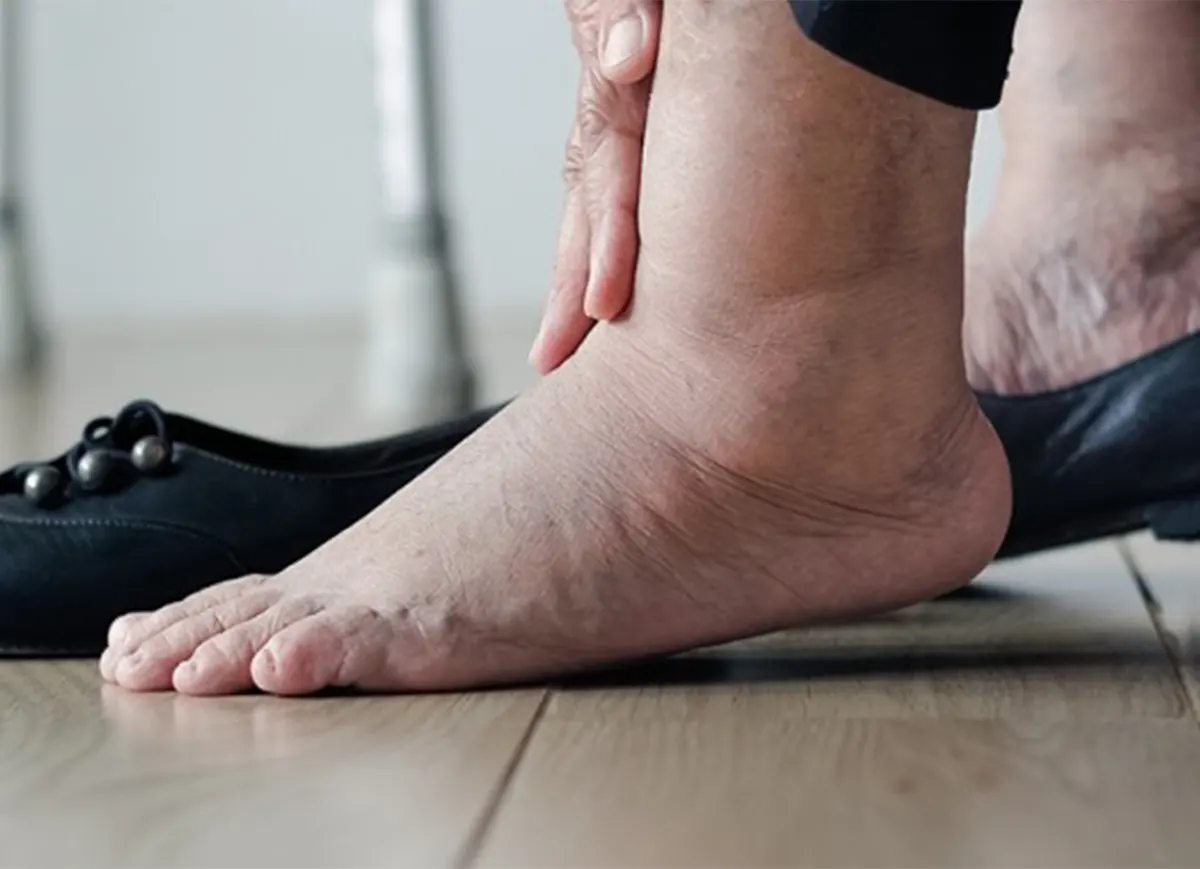 Pieds et chevilles gonflés : 11 remèdes de grand-mère efficaces pour soulager l’œdème naturellement 2 Pieds et chevilles gonflés