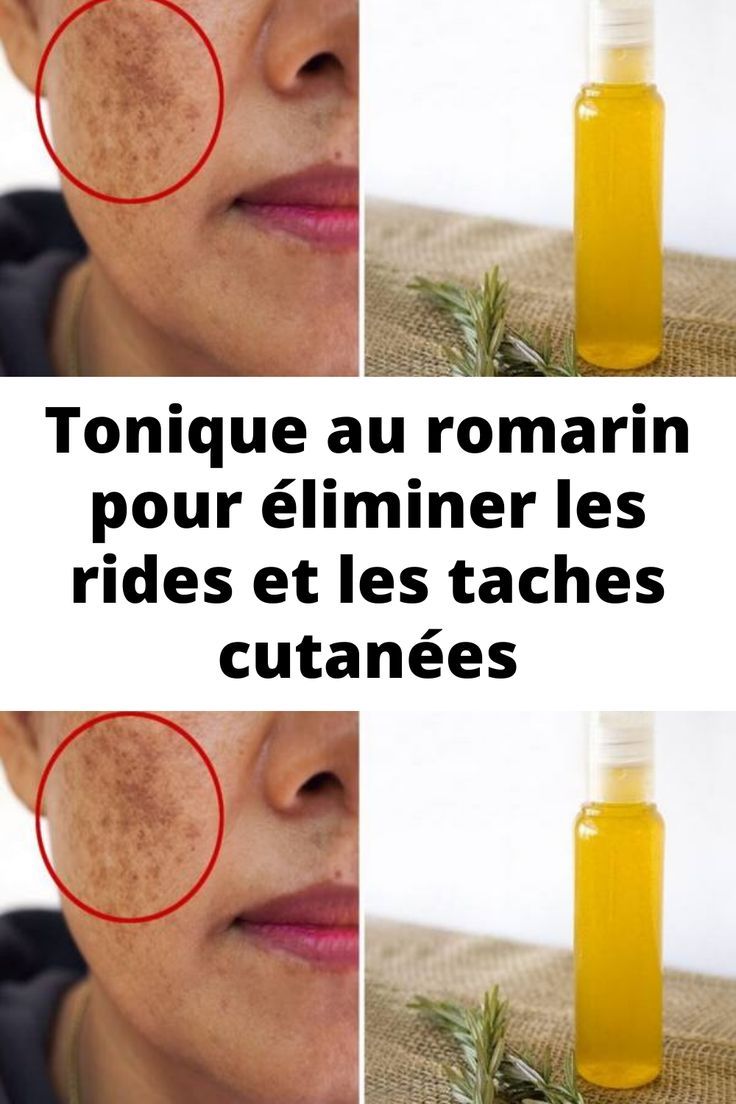 Tonique au romarin pour éliminer les rides et les taches cutanées 2 Tonique au romarin pour éliminer les rides et les taches cutanées