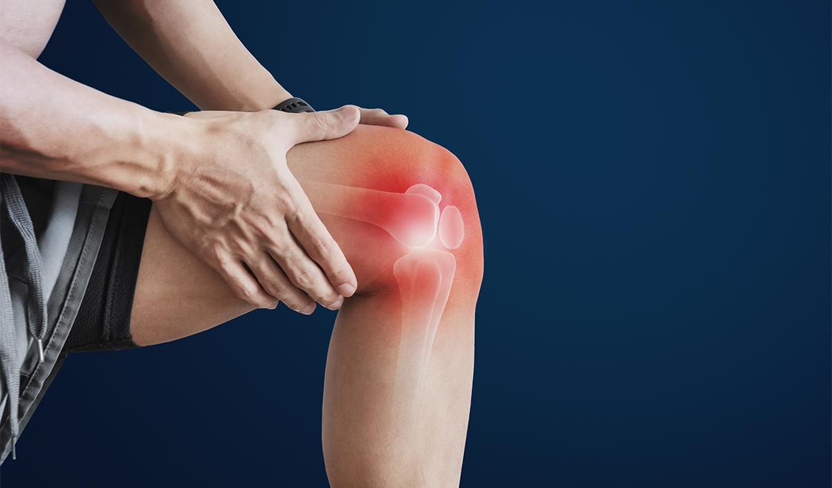 Arthrose du genou : comprendre la maladie articulaire la plus répandue et soulager efficacement les douleurs 4 arthrose du genou