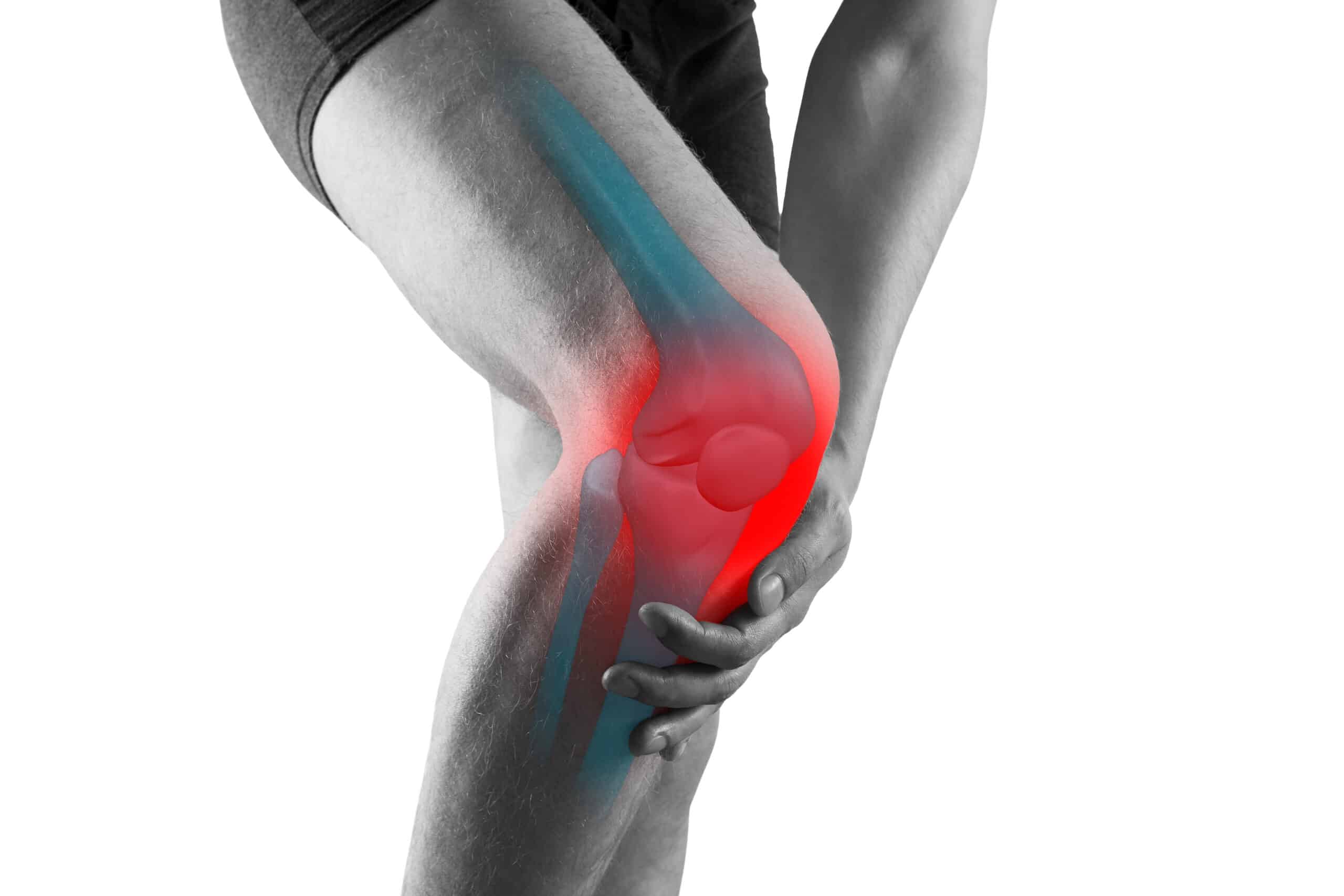 Arthrose du genou : comprendre la maladie articulaire la plus répandue et soulager efficacement les douleurs 2 arthrose du genou