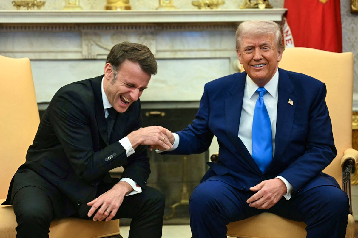 Donald Trump lève le voile sur les hématomes qui intriguent
